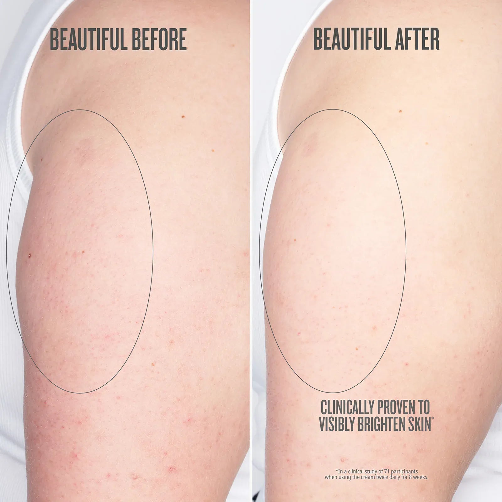5_CLINICALBEFOREANDAFTER_DTC_7f37a0ad-4642-4b49-8f1b-3b00123b893c.jpg